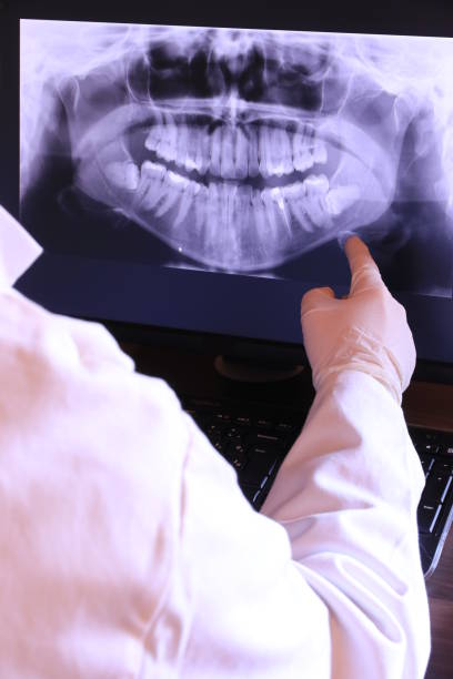 Best Emergency Root Canal Treatment in Gentry, AR