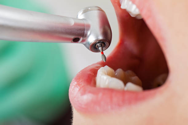 Best Emergency Wisdom Teeth Removal in Gentry, AR